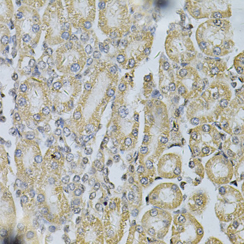 Anti-PDGFB Antibody (CAB1195)