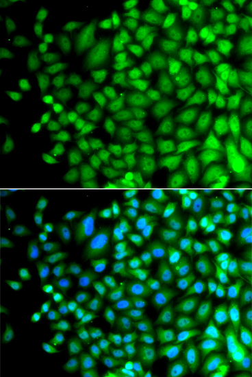 Anti-SUPT20H Antibody (CAB7374)