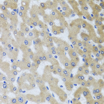 Anti-UVRAG Polyclonal Antibody (CAB8462)