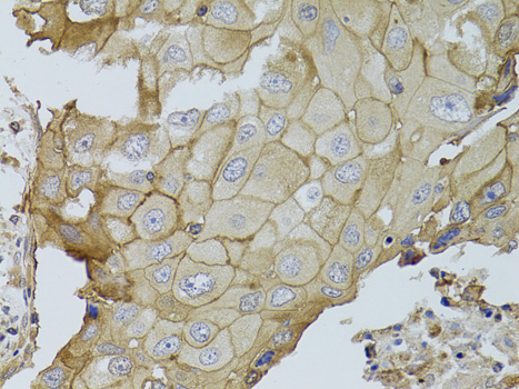 Anti-GGT1 Antibody (CAB1776)