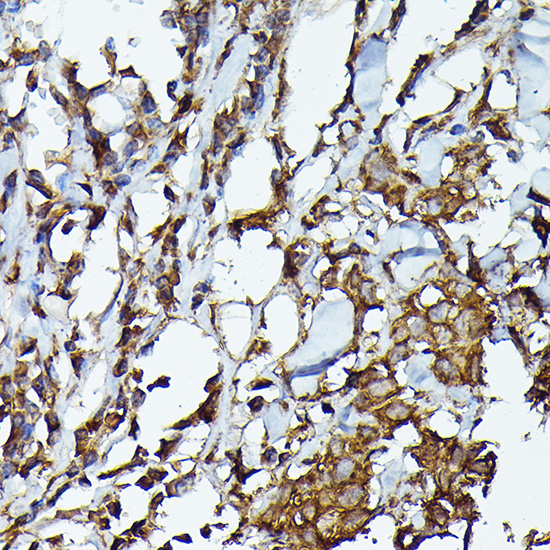 Anti-JAK2 Antibody (CAB11497)