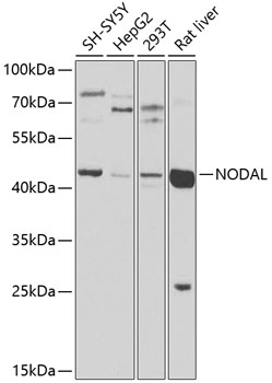 Anti-Nodal homolog Polyclonal Antibody (CAB9902)