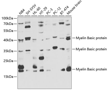 Anti-Myelin Basic protein Antibody (CAB1664)