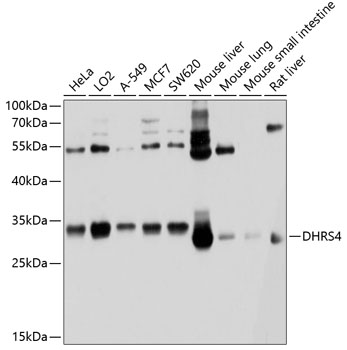 Anti-DHRS4 Antibody (CAB10285)