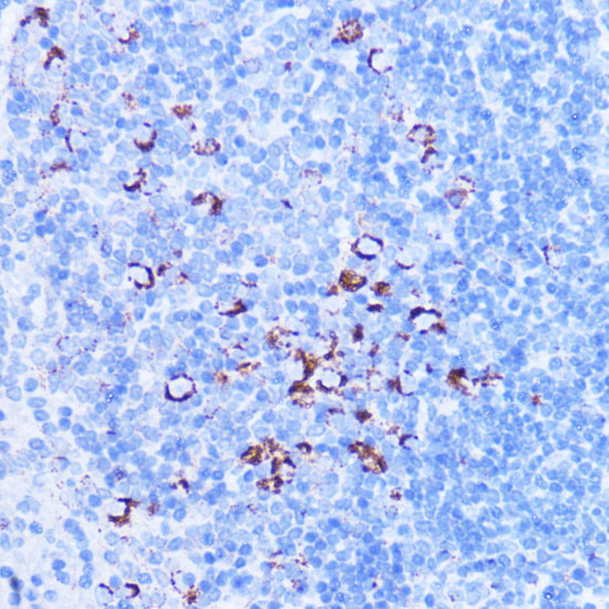 Anti-SHMT2 Antibody [KO Validated] (CAB1215)