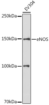 Anti-eNOS Antibody (CAB15075)