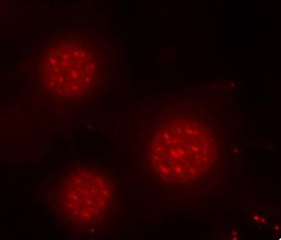 Anti-Phospho-FOXO4-S197 Antibody (CABP0177)