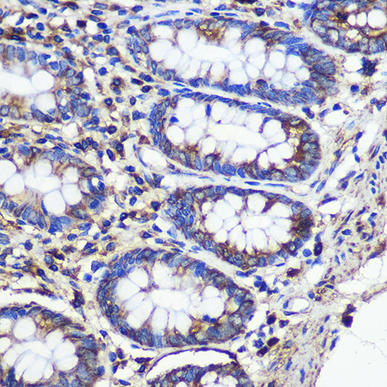 Anti-SND1 Antibody [KO Validated] (CAB5874)