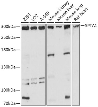 Anti-SPTA1 Antibody (CAB12355)