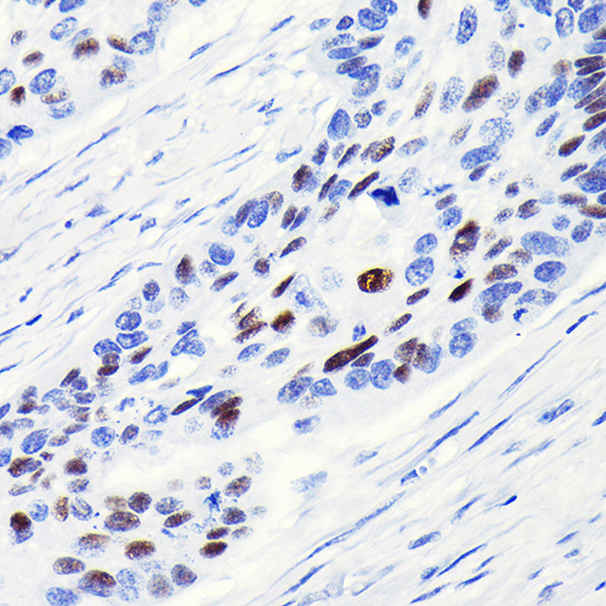 Anti-Cyclin D1 Antibody [KO Validated] (CAB19038)