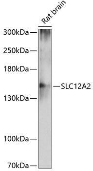 Anti-SLC12A2 Antibody (CAB11675)