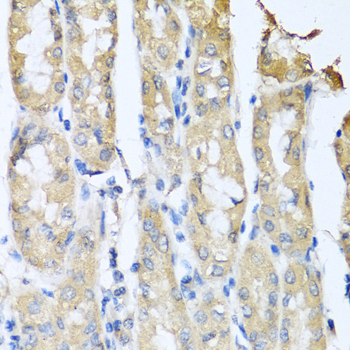 Anti-CCL3 Antibody (CAB7568)