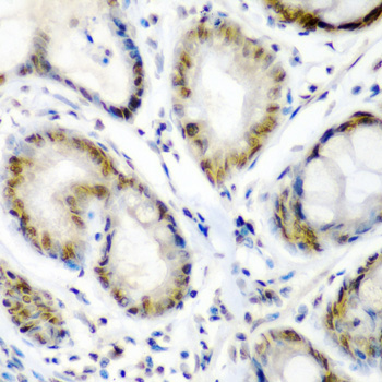 Anti-SS18 Antibody (CAB6990)