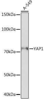 Anti-YAP1 Antibody (CAB19134)