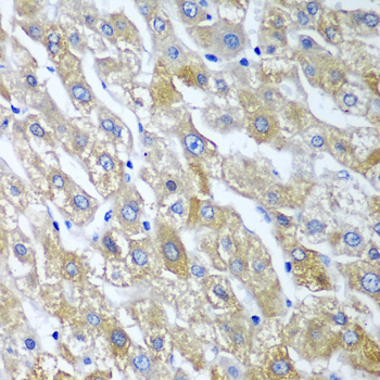 Anti-SGSH Polyclonal Antibody (CAB8148)