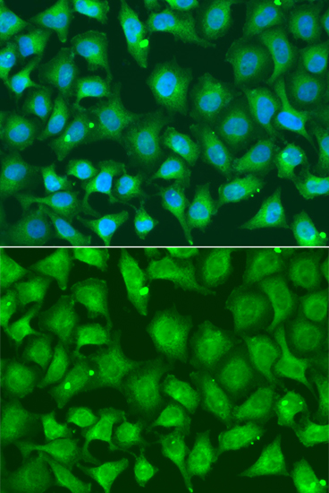 Anti-XRCC2 Antibody (CAB13639)