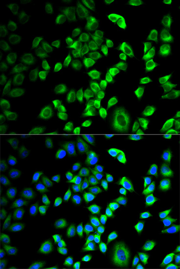 Anti-SERPINH1 Antibody (CAB2517)