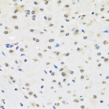 Anti-SAFB2 Antibody (CAB4330)