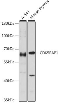 Anti-CDK5RAP1 Antibody (CAB15844)