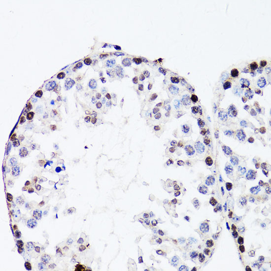 Anti-FGF12 Antibody (CAB2667)