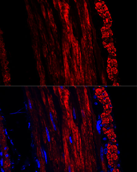 Anti-alpha smooth muscle actin Antibody (CAB7248)