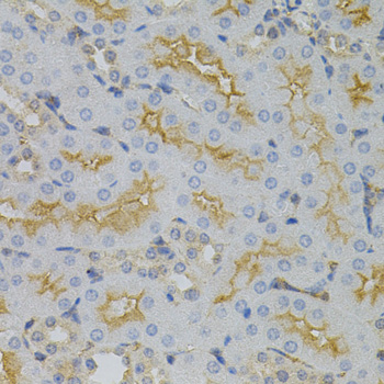 Anti-CDKN2C/p18-INK4C Antibody (CAB12418)