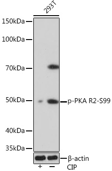 Anti-Phospho-PKA R2-S99 Antibody (CABP1034)