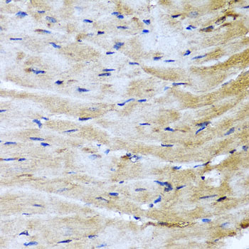 Anti-M6PR Antibody (CAB6296)