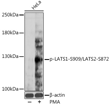 Anti-phospho-LATS1-S909/LATS2-S872 Antibody (CABP0904)