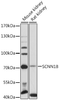 Anti-SCNN1B Antibody (CAB12699)