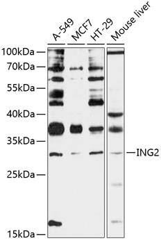 Anti-ING2 Antibody (CAB12266)