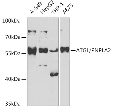 Anti-ATGL/PNPLA2 Antibody (CAB6245)