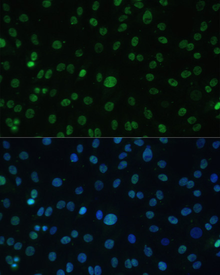 Anti-HSF1 Antibody (CAB13765)