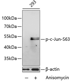 Anti-Phospho-Jun-S63 Antibody (CABP0048)