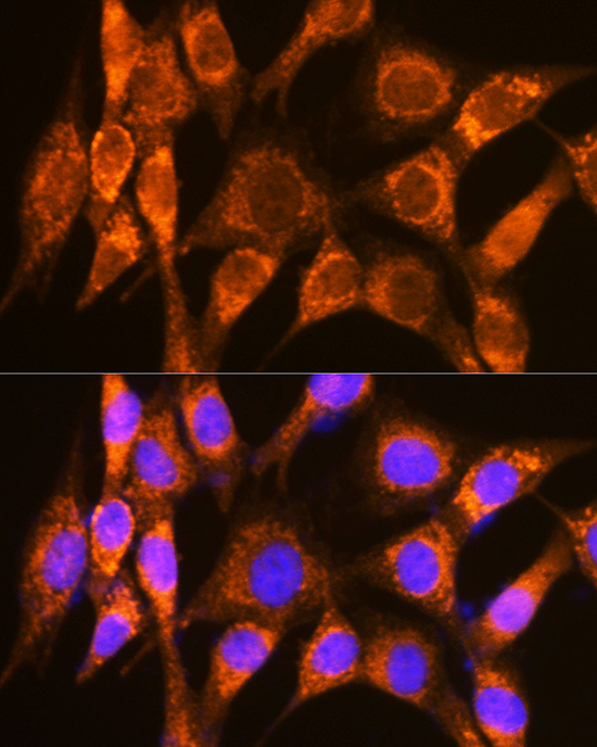 Anti-DMT1 Antibody (CAB10231)