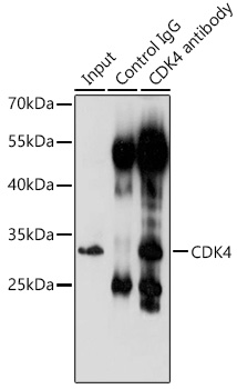 Anti-CDK4 Antibody (CAB0366)