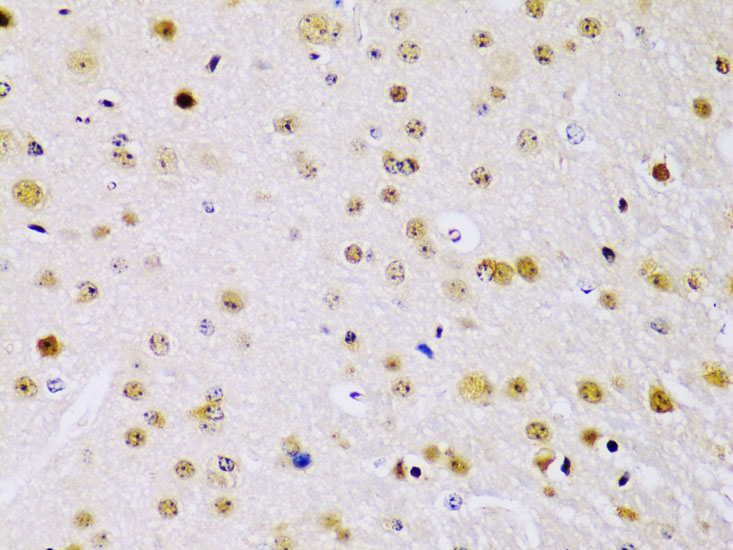 Anti-IKKBeta Antibody (CAB2087)