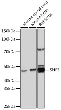 Anti-SNF5 Antibody [KO Validated] (CAB3247)