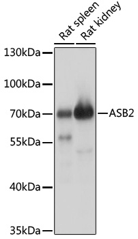 Anti-ASB2 Antibody (CAB17923)