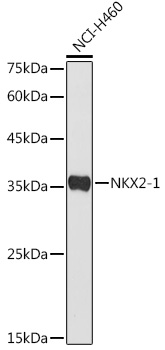 Anti-NKX2-1 Antibody (CAB3097)