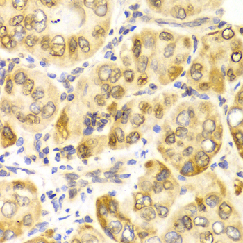 Anti-CPT2 Antibody (CAB2876)