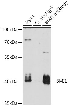 Anti-BMI1 Antibody (CAB0211)