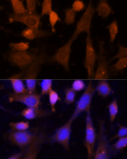 Anti-VPS26A Antibody (CAB14265)