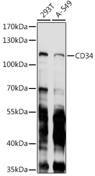 Anti-CD34 Mouse Monoclonal Antibody