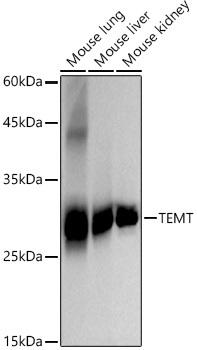 Western blot analysis of extracts of various cell lines, using TEMT antibody at 1:2000 dilution. Secondary antibody: HRP Goat Anti-Rabbit IgG (H+L) at 1:10000 dilution. Lysates/proteins: 25ug per lane. Blocking buffer: 3% nonfat dry milk in TBST. Detection: ECL Basic Kit. Exposure time: 10s.