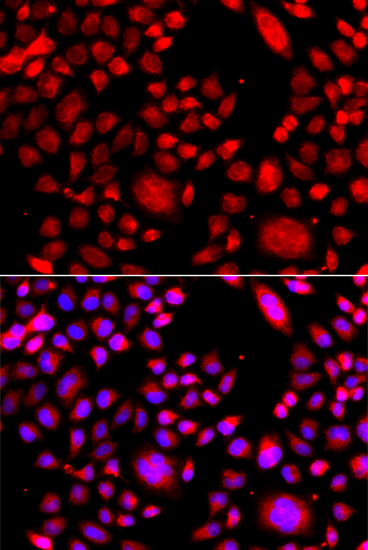 Anti-RAC3 Antibody (CAB7498)