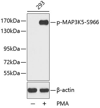 Anti-Phospho-MAP3K5-S966 Antibody (CABP0194)