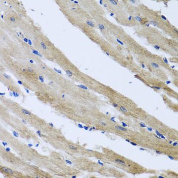 Anti-ST8SIA2 Antibody (CAB7748)