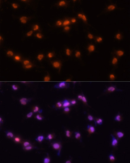 Anti-PRPF8 Antibody (CAB6053)