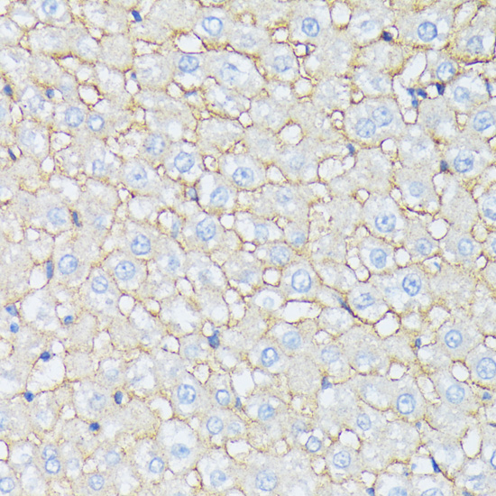 Anti-CTNNA2 Antibody (CAB15269)